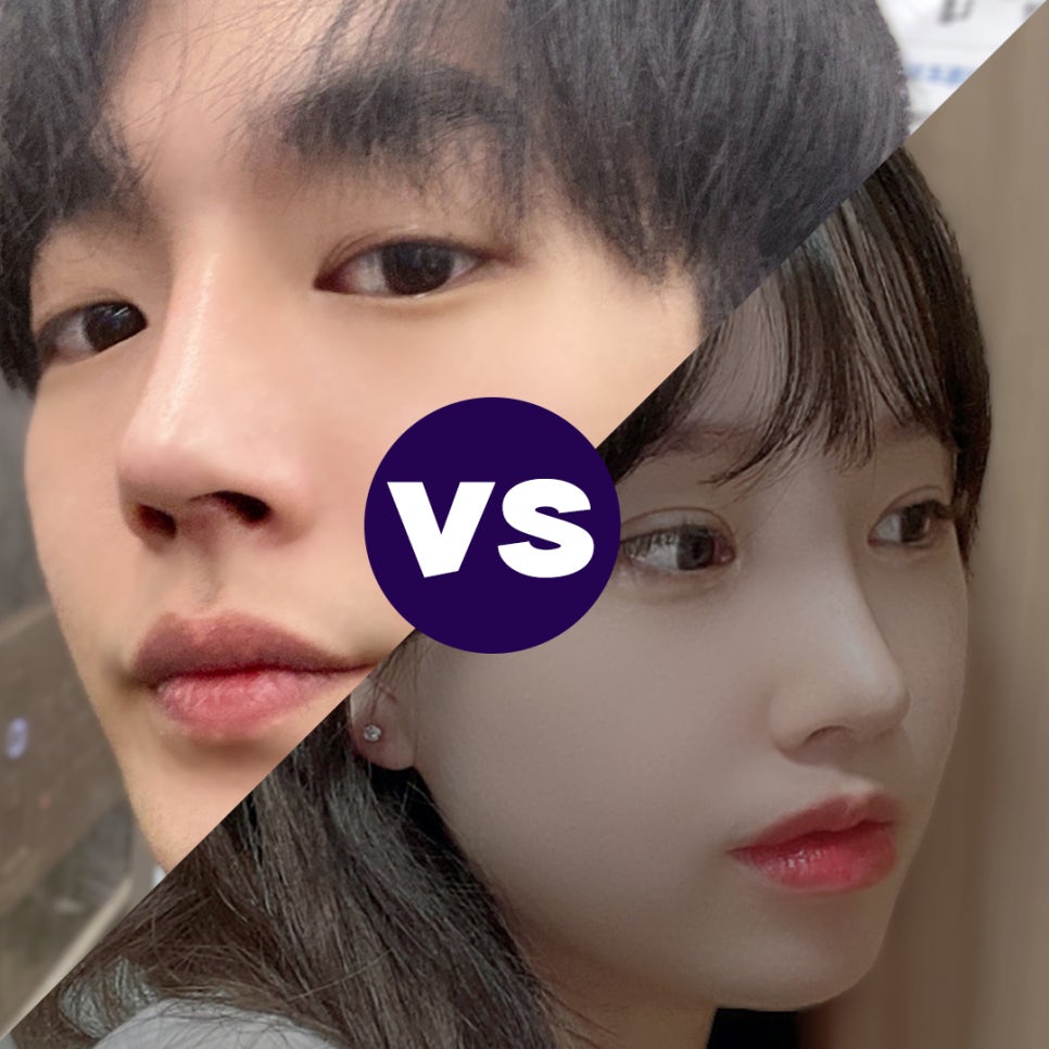 오지코성형외과_남자성형전후 만족스러운 결과 관련 이미지 6