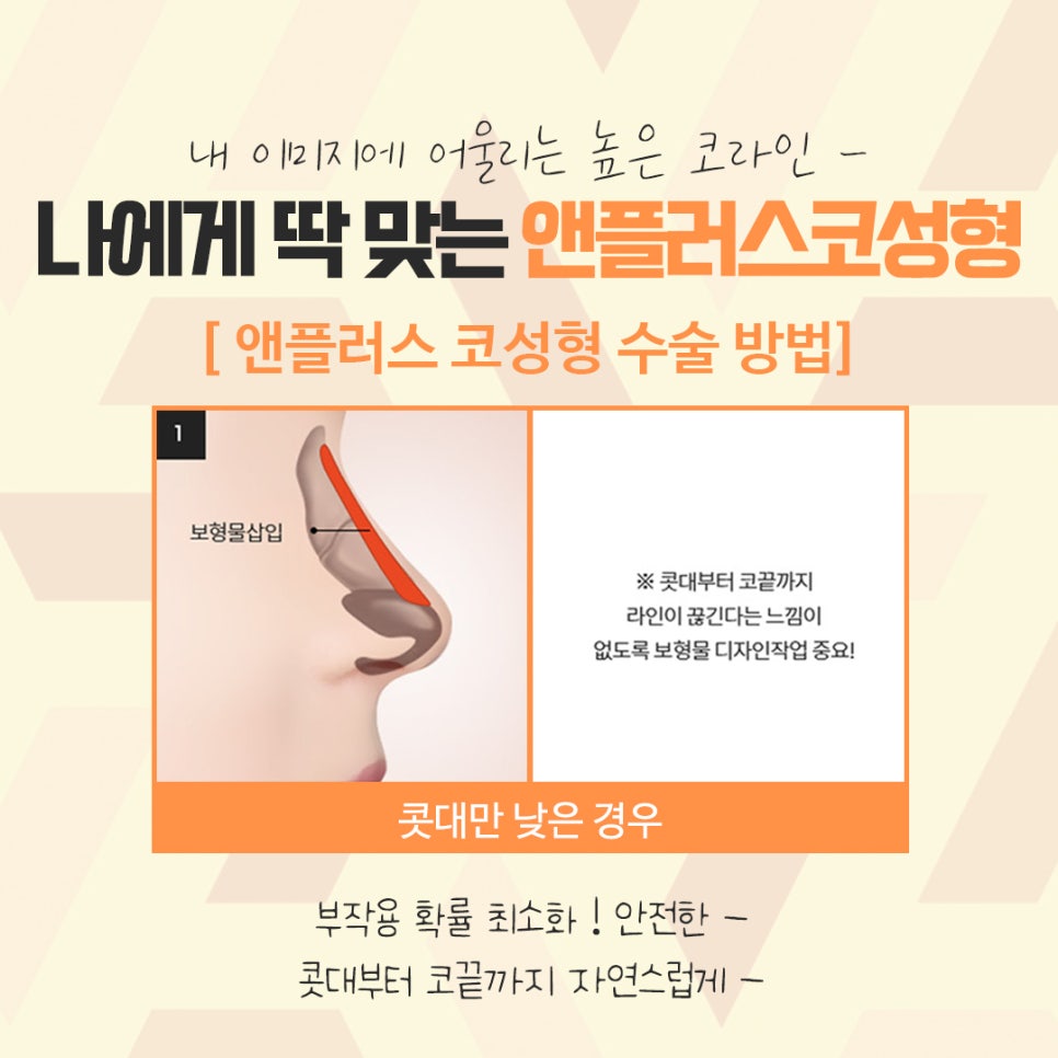 자가연골코수술을 통한 이미지 개선 관련 이미지 9