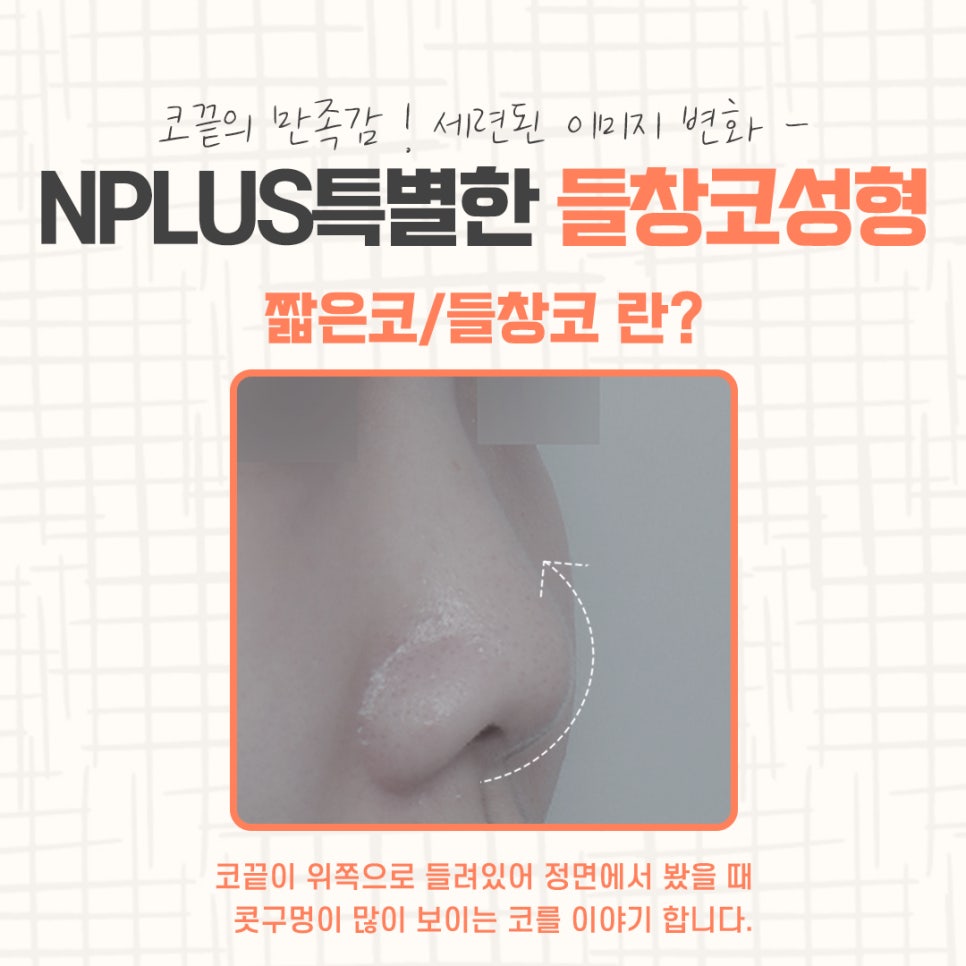 들창코수술에 대한 차이점을 알아보고 관련 이미지 4