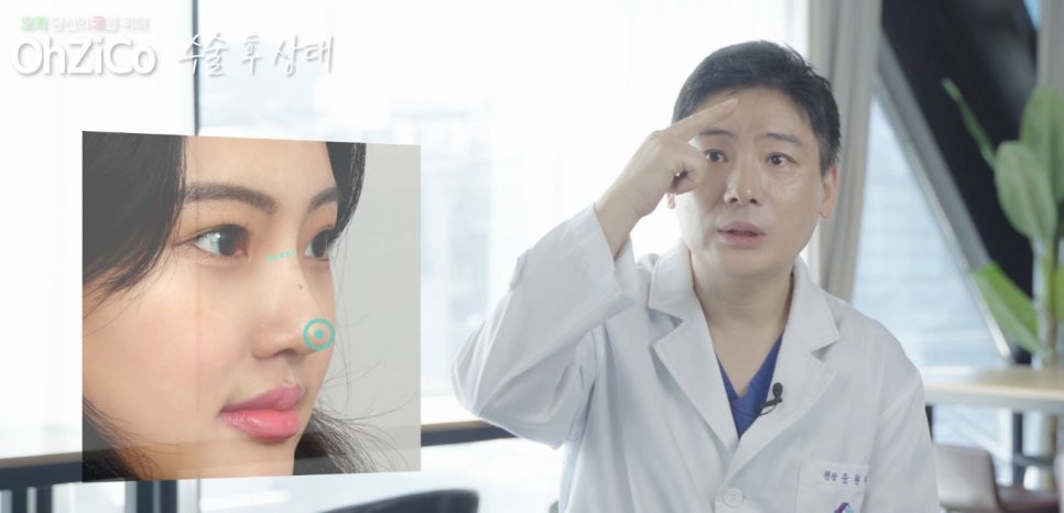 짧은코수술 후기까지 자세하게 알아보고 관련 이미지 17