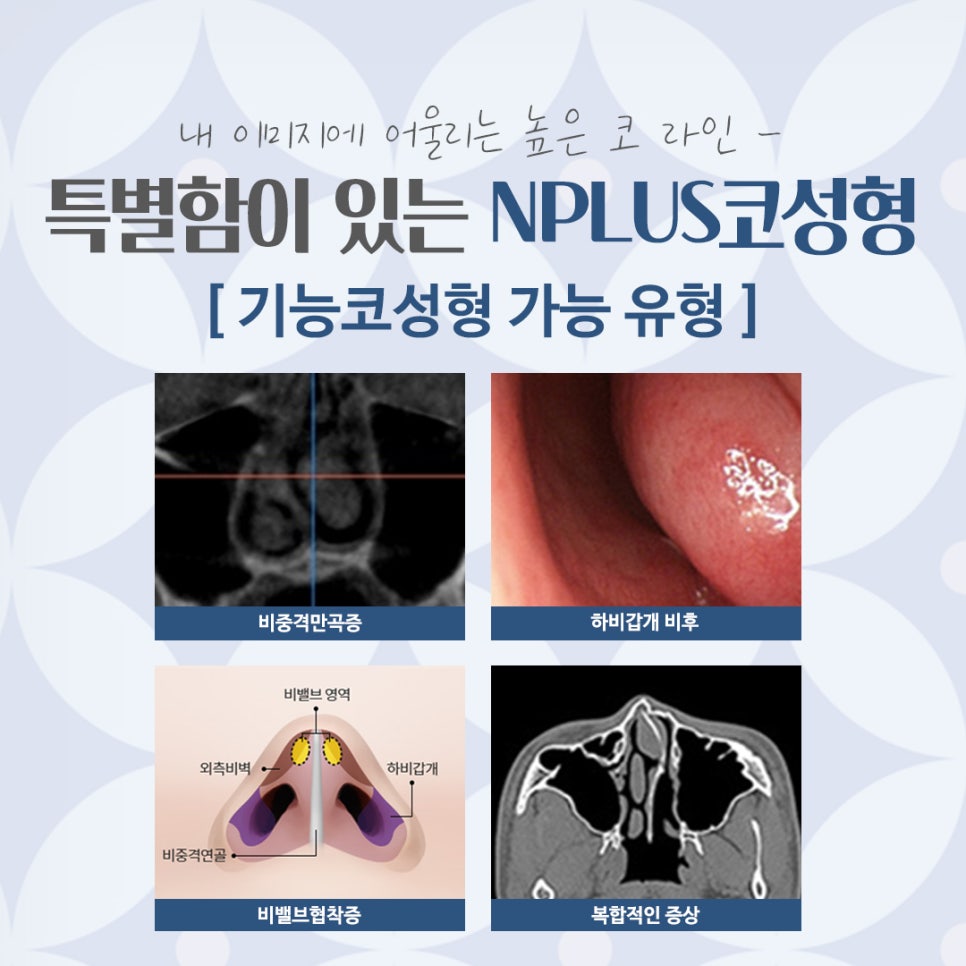 Carefully Checking a Rhinoplasty Clinic image 5