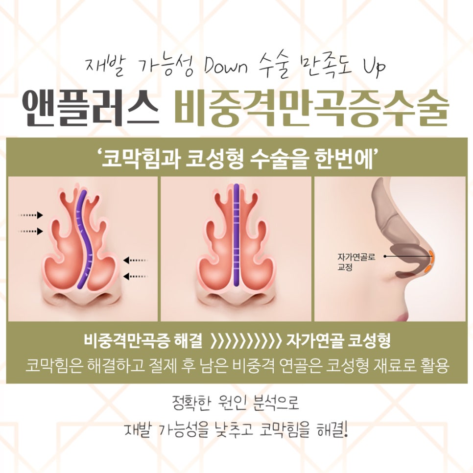 Septoplasty Surgery Review: Accurately Identifying the Cause image 9