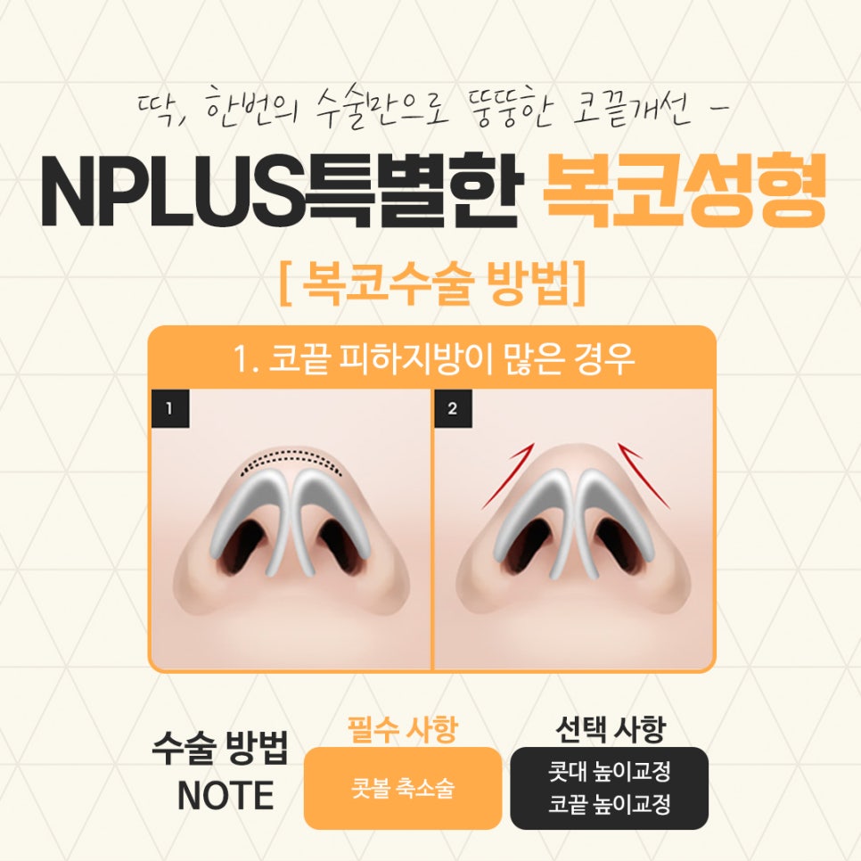 복코수술후기 정확한 진단을 통하여 관련 이미지 8