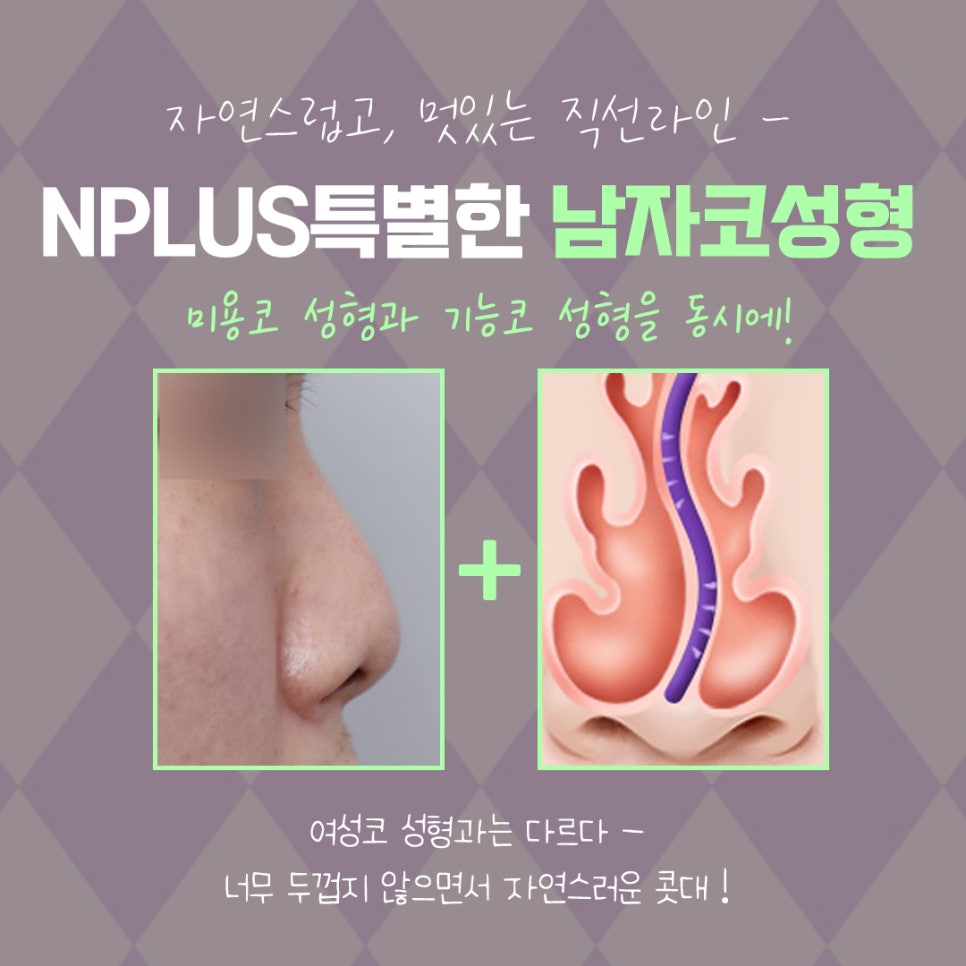 남자코성형후기 변화된 이미지를 확인 관련 이미지 9