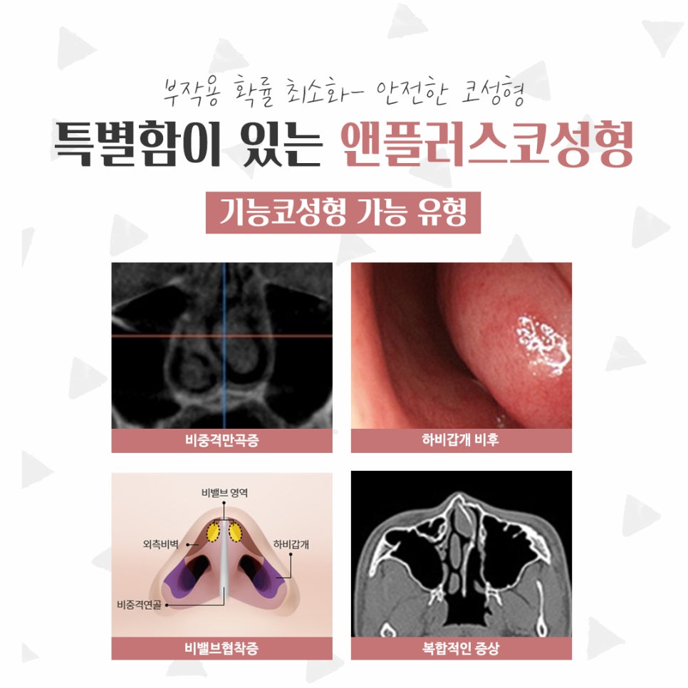 Before and After Female Nose Surgery for a Satisfying Result image 5
