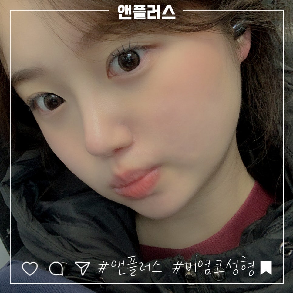 비염코성형후기 원인을 자세하게 알아보고 관련 이미지 1