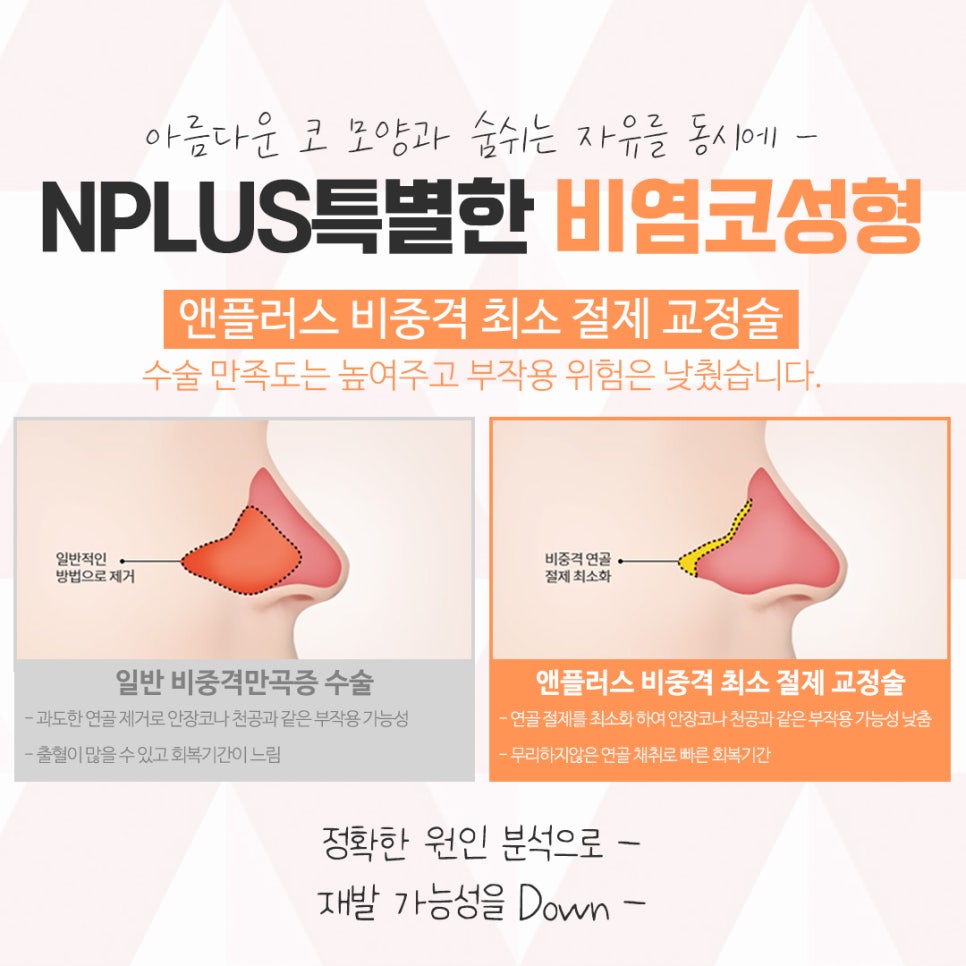 비염의원인과 해결 방법에 대해 관련 이미지 9