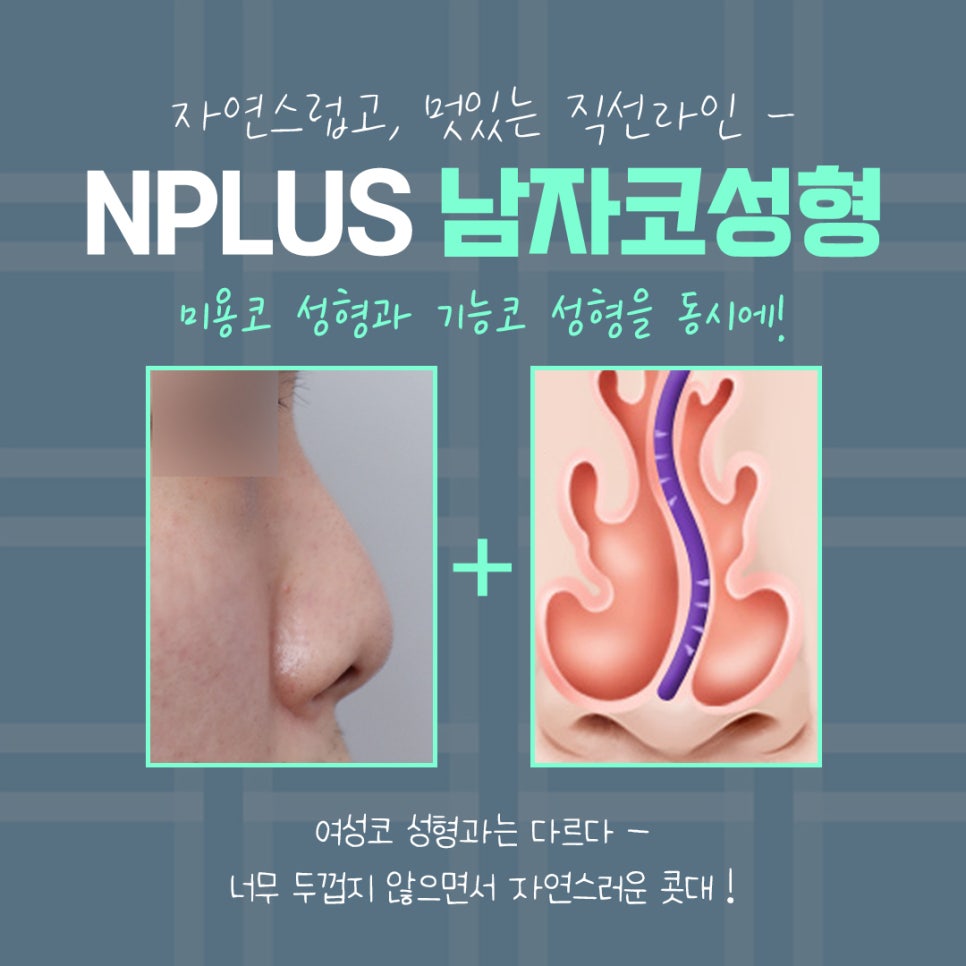 남자코수술전후 변화를 확인해 보고 관련 이미지 6