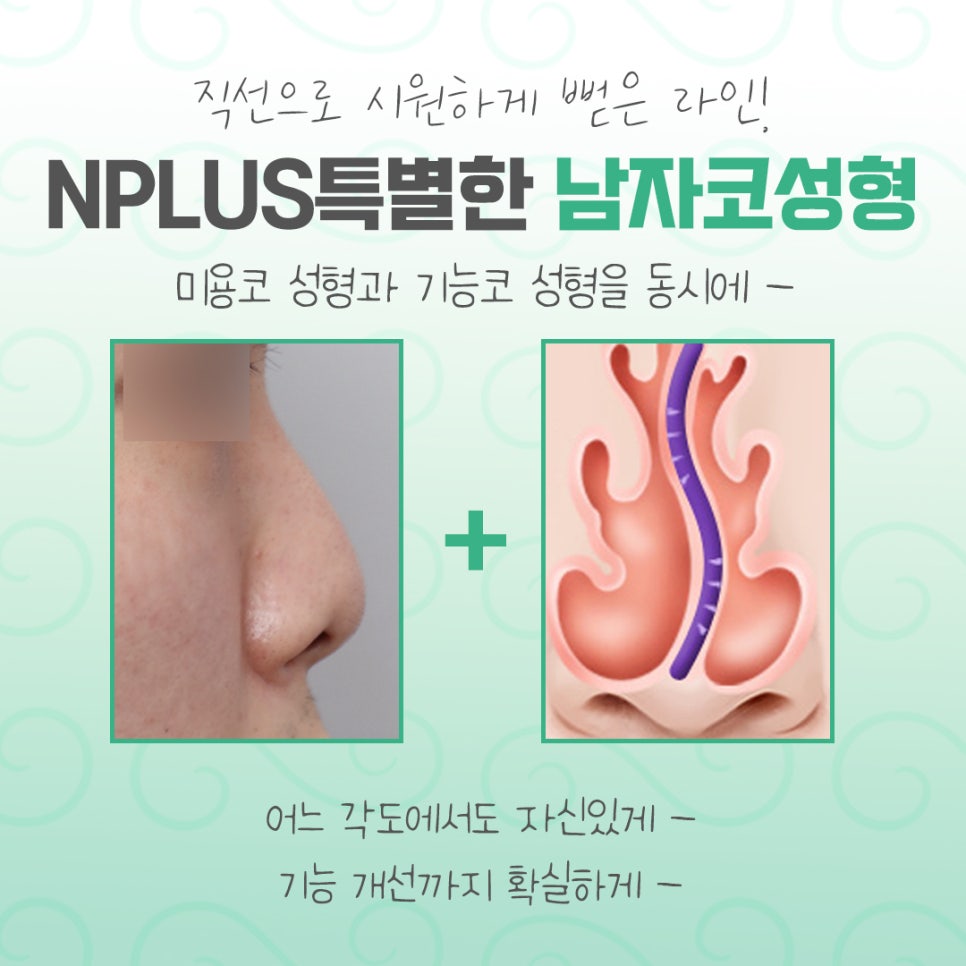 남자코수술후기를 자세하게 알아보고 관련 이미지 4