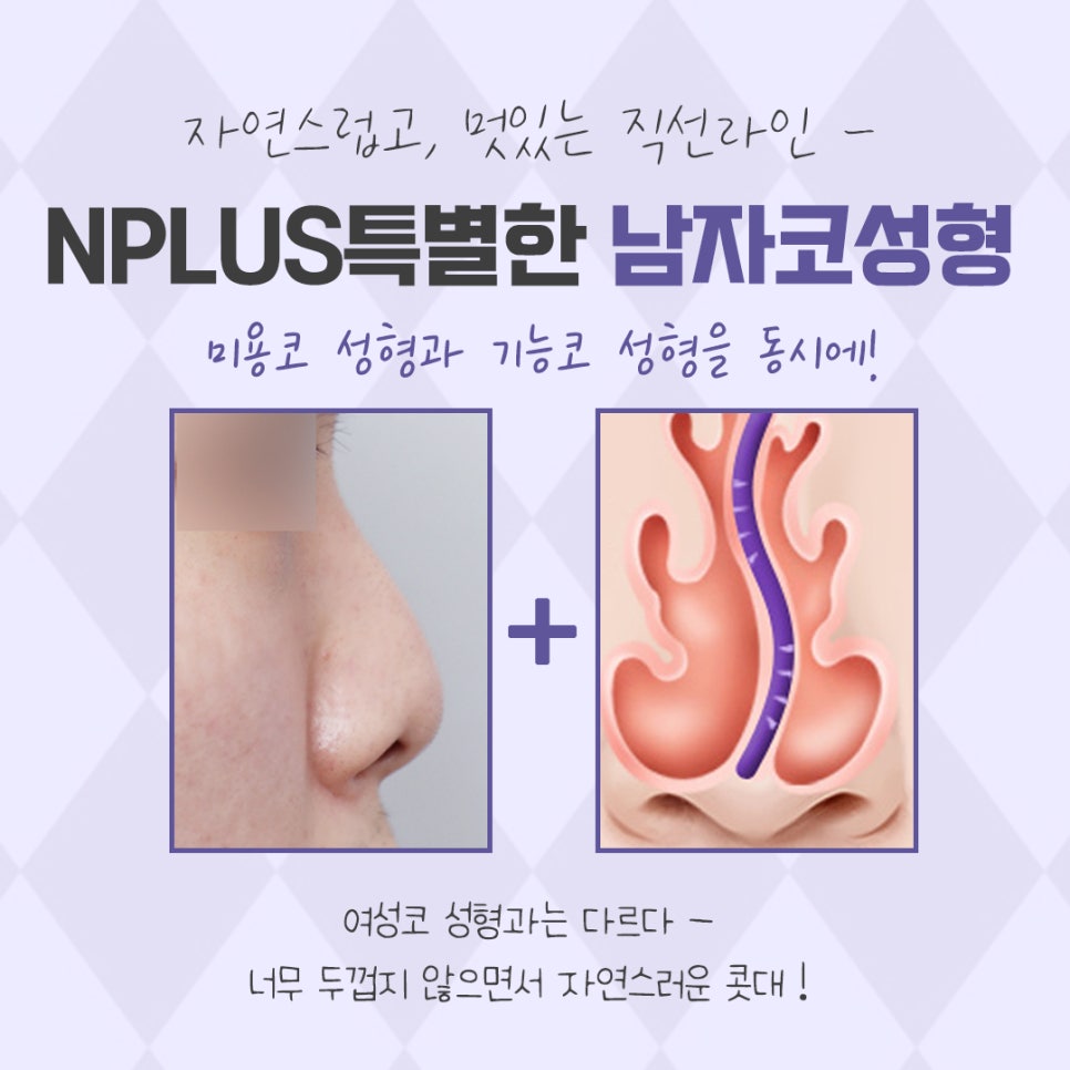 남자코성형후기 내부까지 확인하여 관련 이미지 4