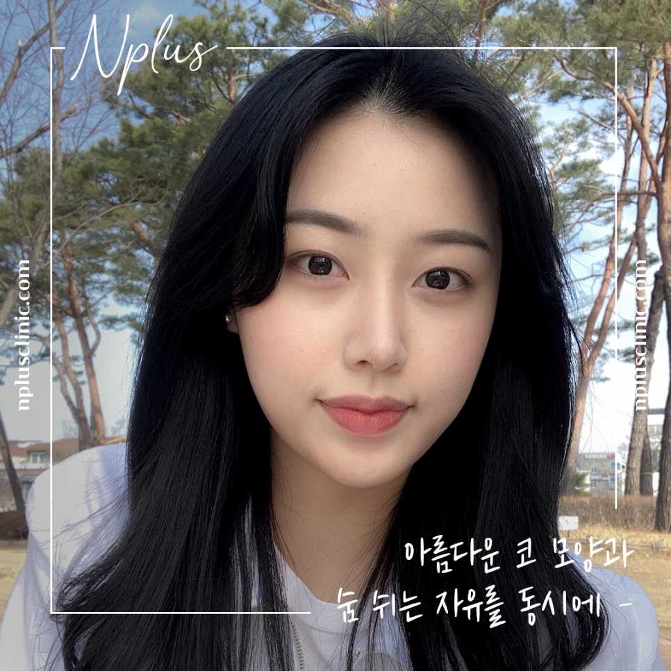 자가늑코수술에 대해 자세히 찾아보고 관련 이미지 3