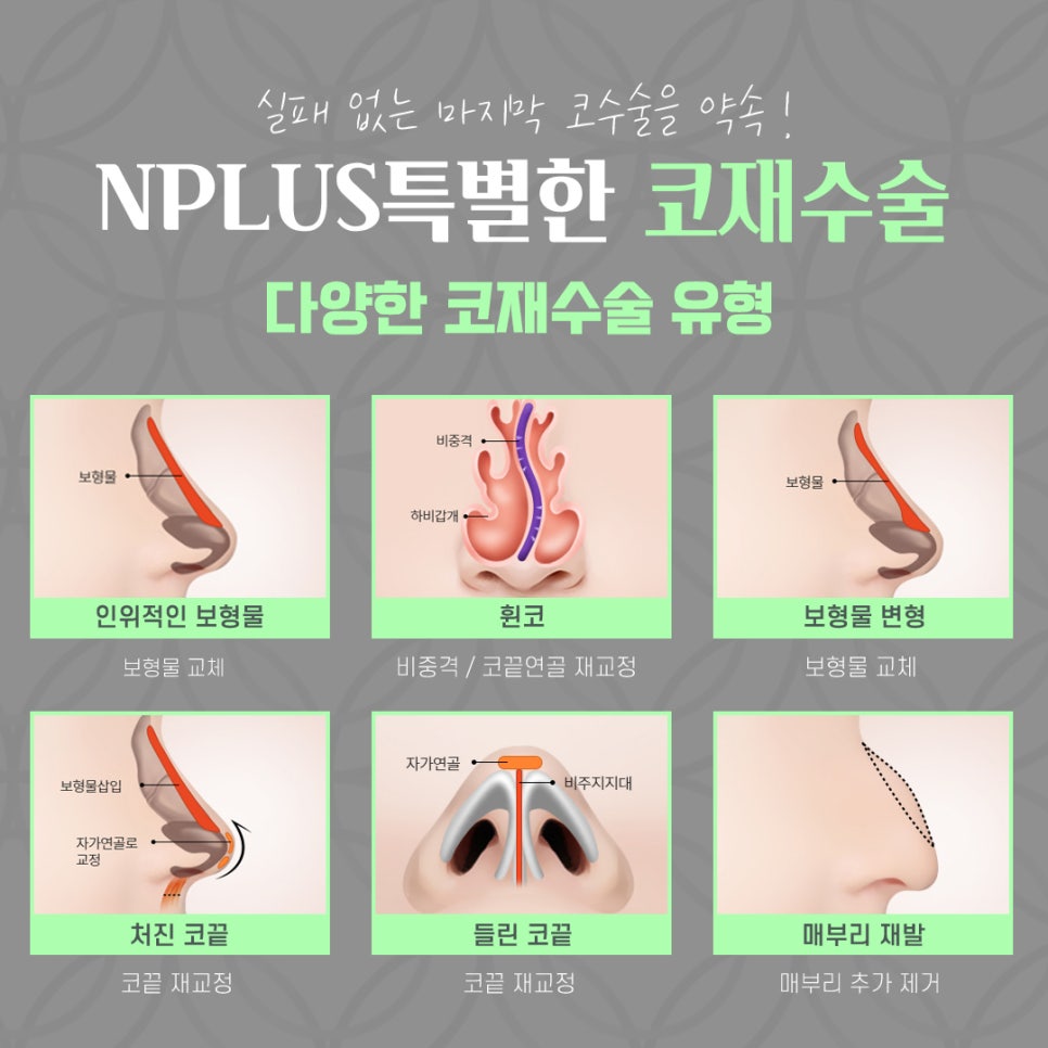 코재수술후기 확실하게 진단하여 관련 이미지 4