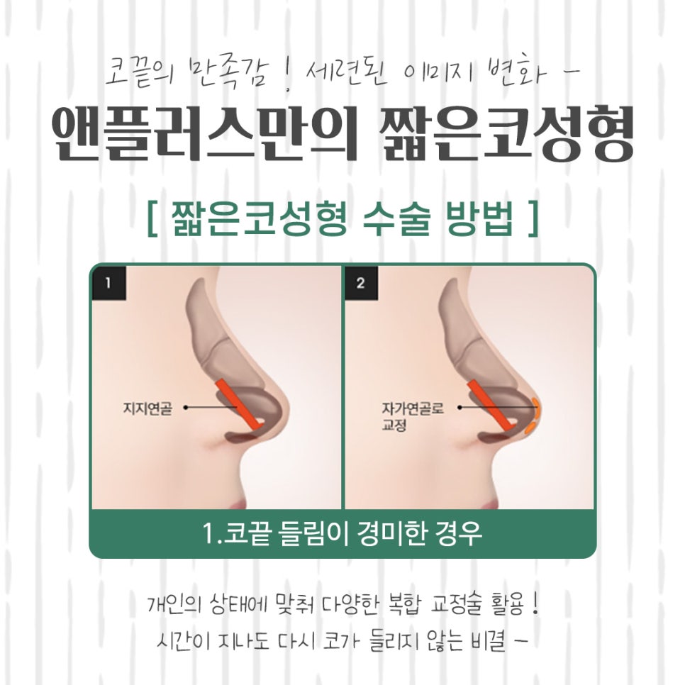 들린코수술후기 기능까지 확인하고 관련 이미지 10