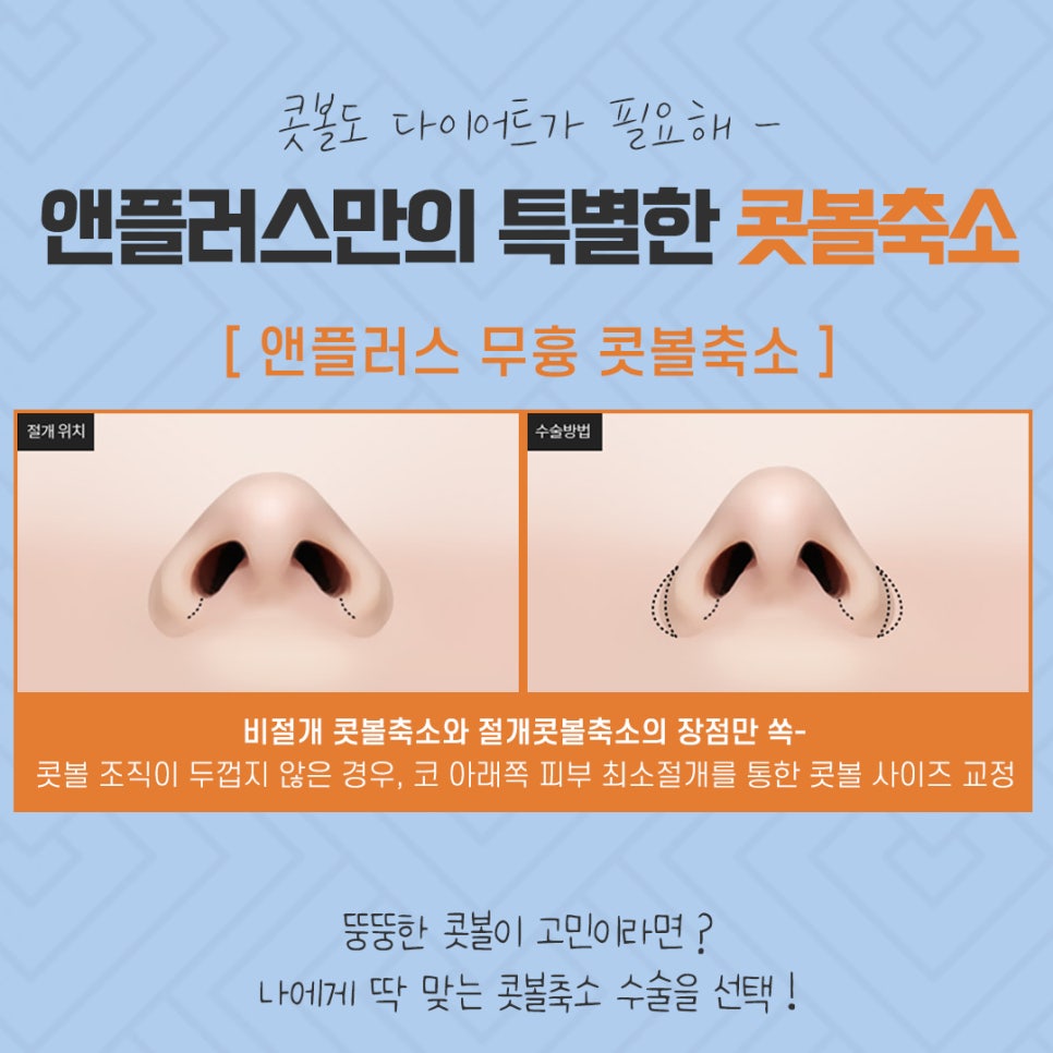콧볼축소후기 섬세하게 알아보고 관련 이미지 8