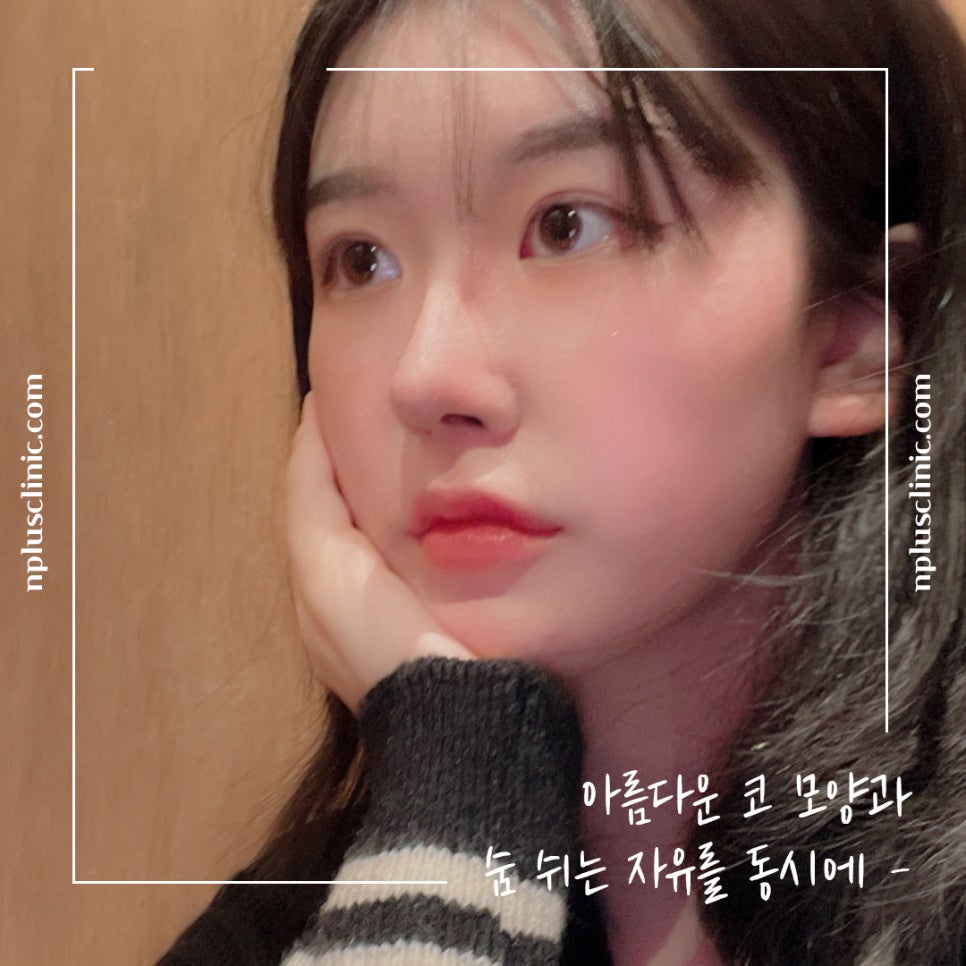 코수술전후 확실한 변화로 관련 이미지 13