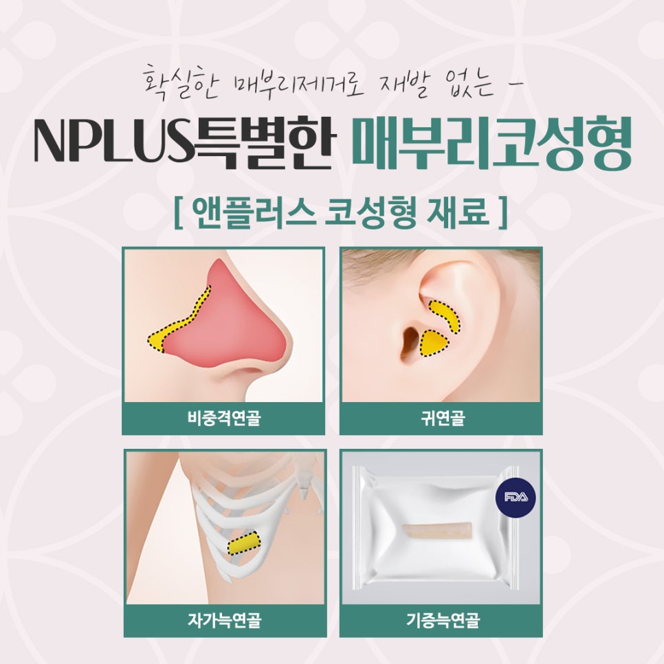 매부리코성형후기 다양한 내용을 찾아보고 관련 이미지 11