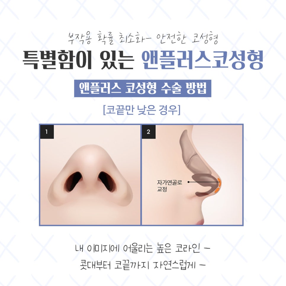 Looking Closely at the Differences Before and After Nose Surgery image 10