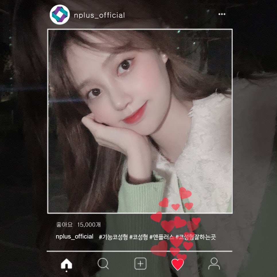 콧볼축소후기 확실하게 알아보고 관련 이미지 1