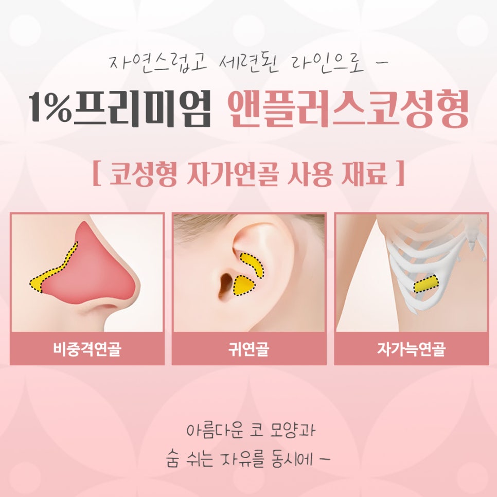 늑연골코수술을 통해 세련된 라인으로 관련 이미지 4