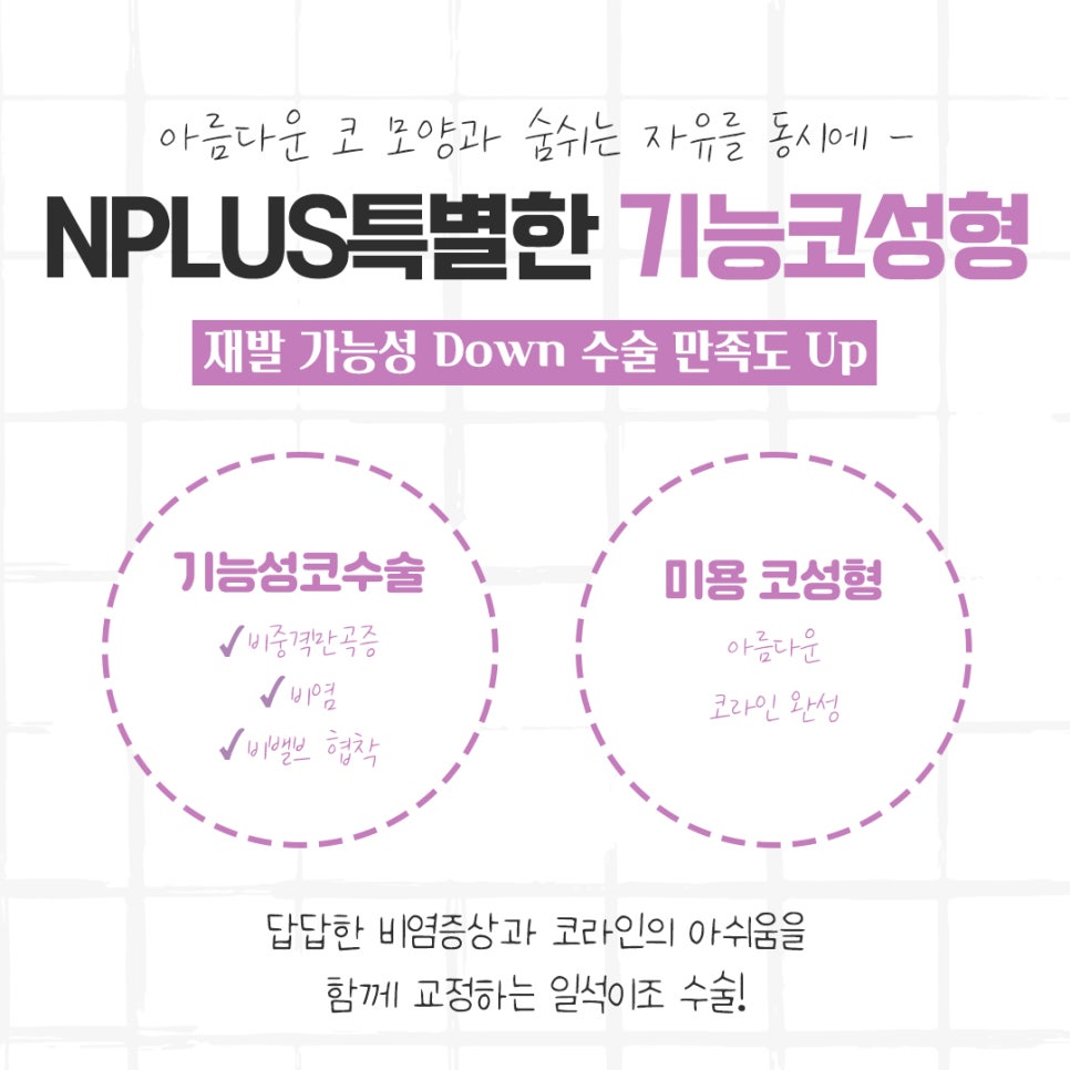 코성형후기 자연스럽고 아름답게 관련 이미지 4