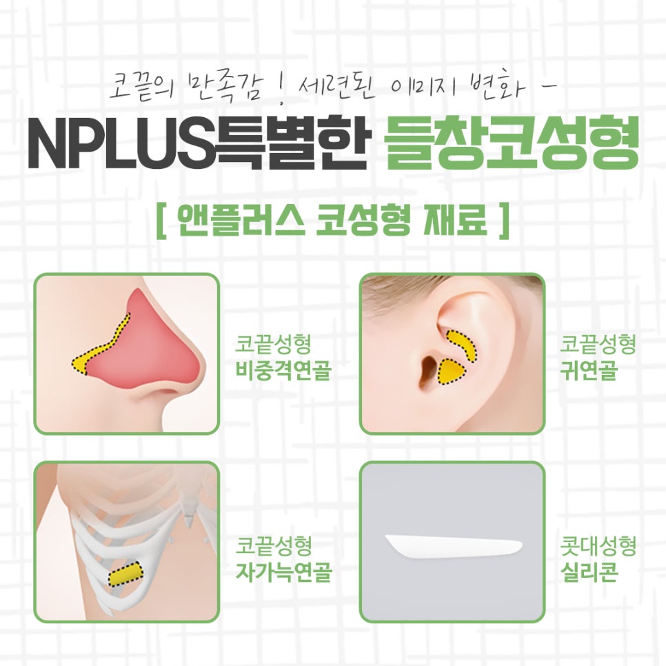 들창코성형 차이를 확인하고 관련 이미지 10