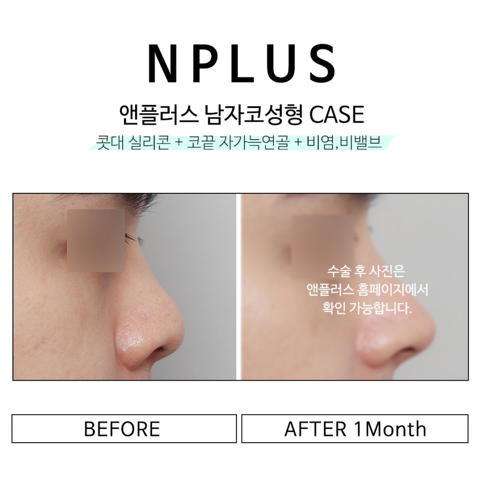 남자연예인코 보고 본인에게 어울리는 남자코라인 찾기 관련 이미지 11