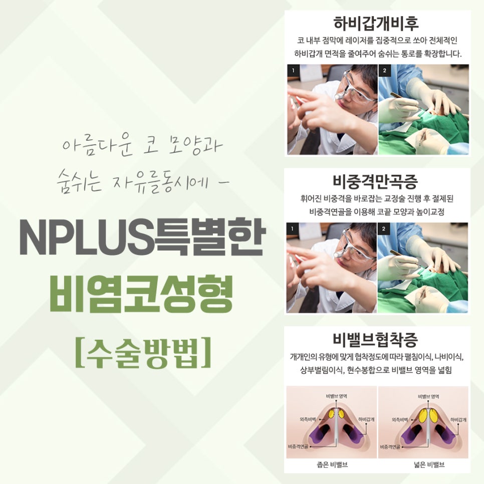 비염코수술후기에 대해 확인하여 관련 이미지 7