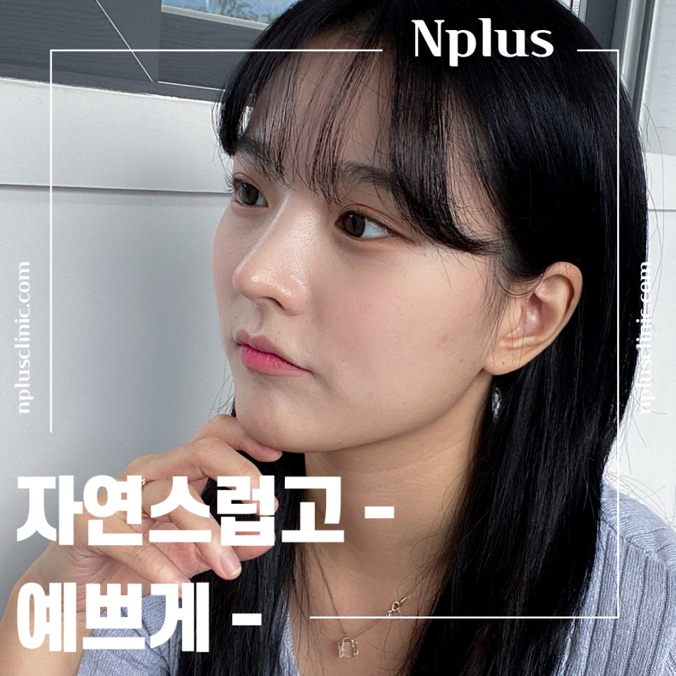 Nose Surgery Review with a Natural Nose Line image 2