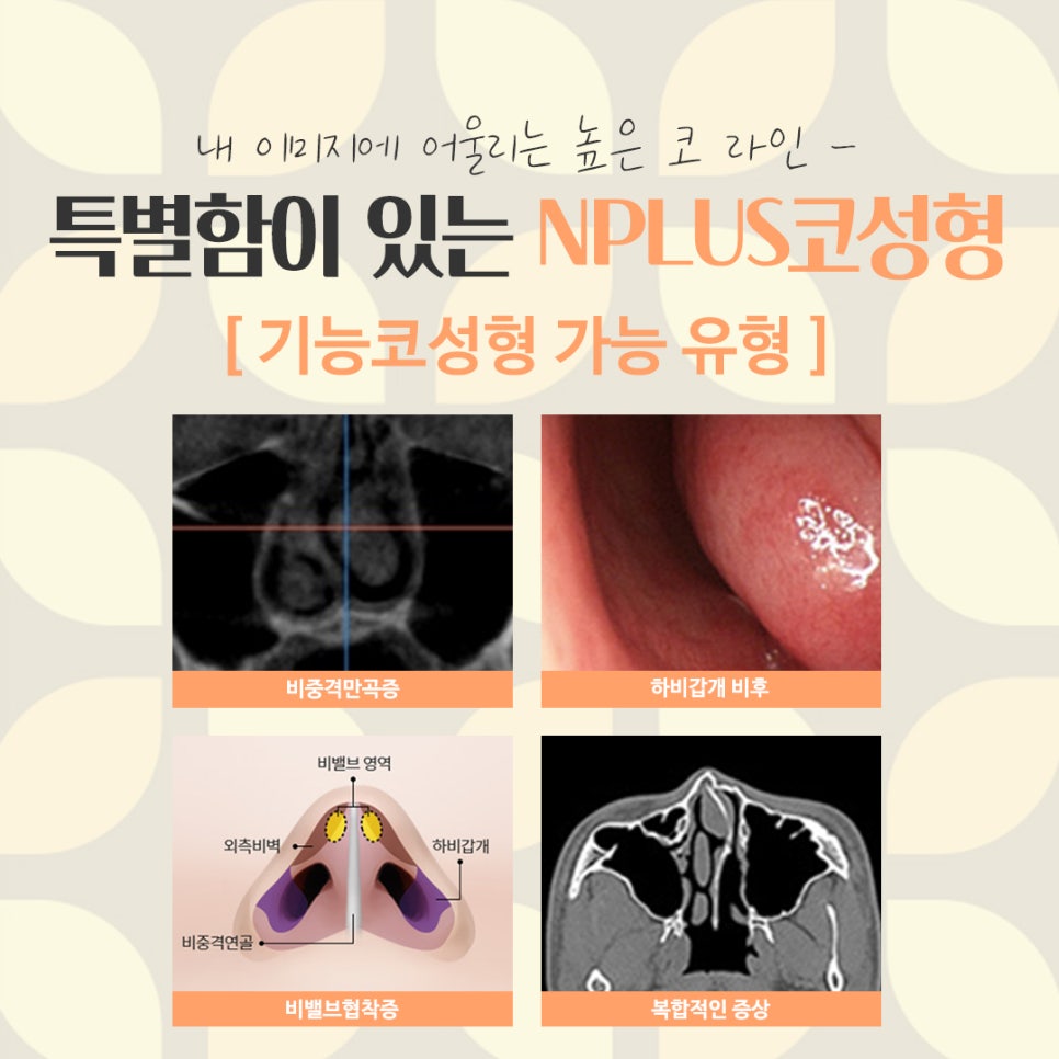 Looking into Reviews of Female Rhinoplasty in Detail image 5