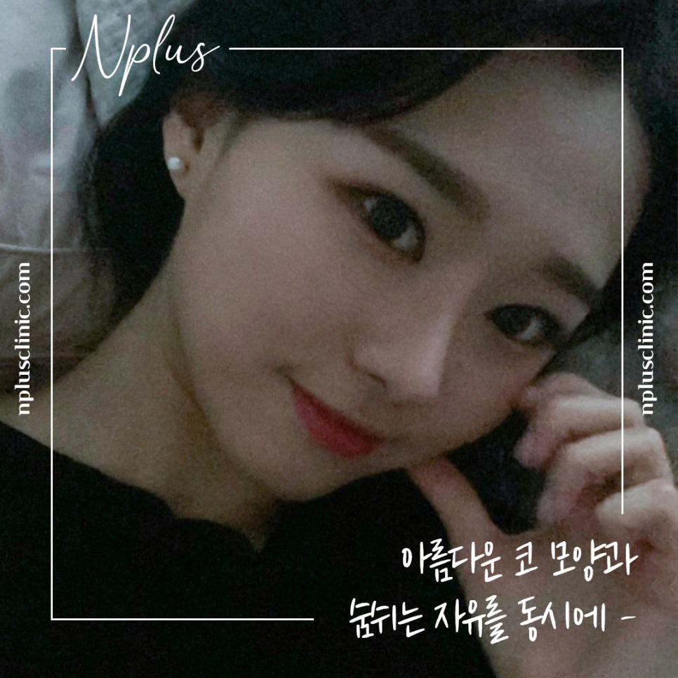 콧볼축소수술 후기까지 확인하고 결정 관련 이미지 13