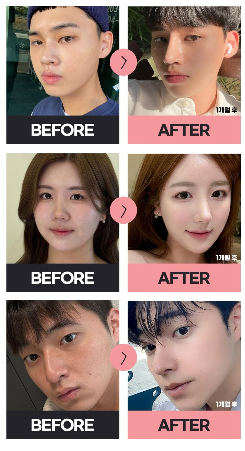 A+ Hospital Student Nose Surgery Event! image 6