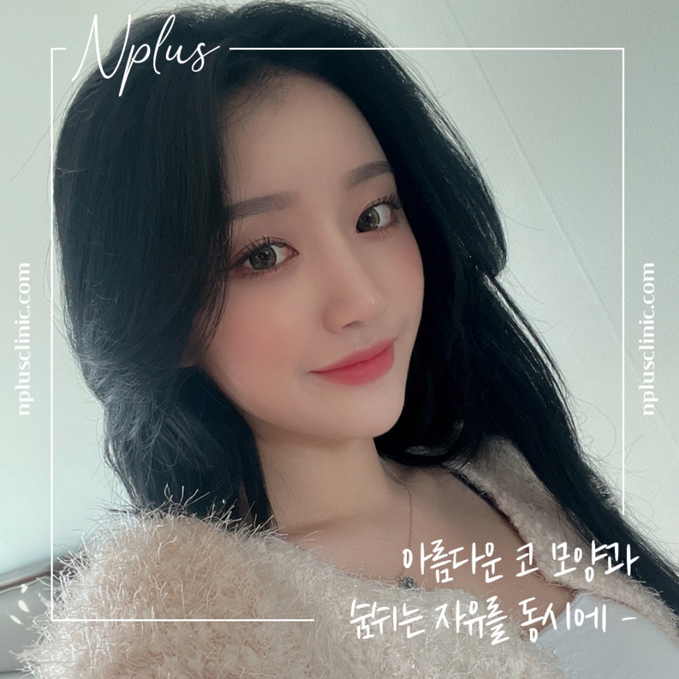 콧볼축소수술후기의 차이를 비교해 보고 관련 이미지 4