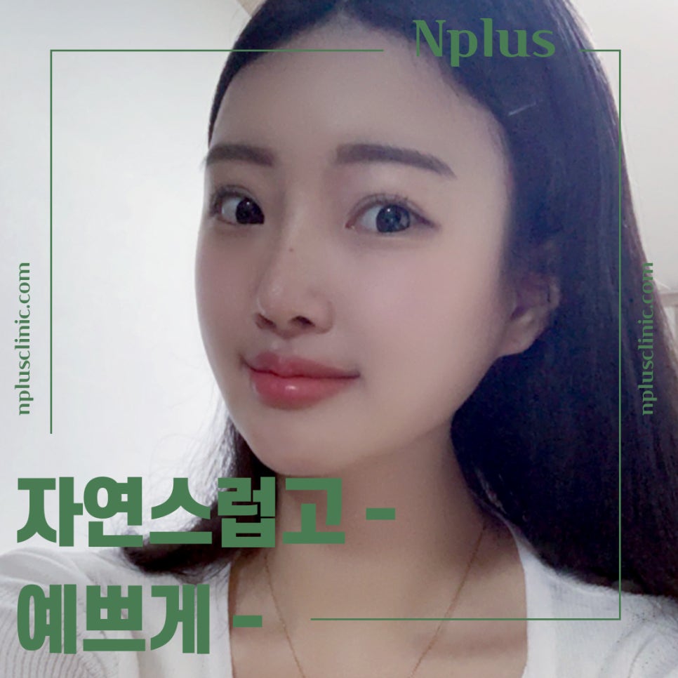 Nose Surgery Review Using Autologous Cartilage image 2
