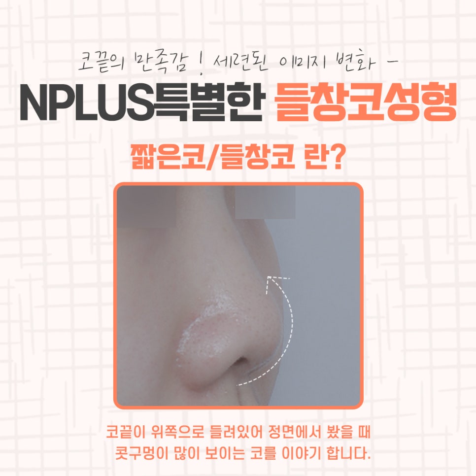 Learn More About Upturned Nose Rhinoplasty in Detail image 3