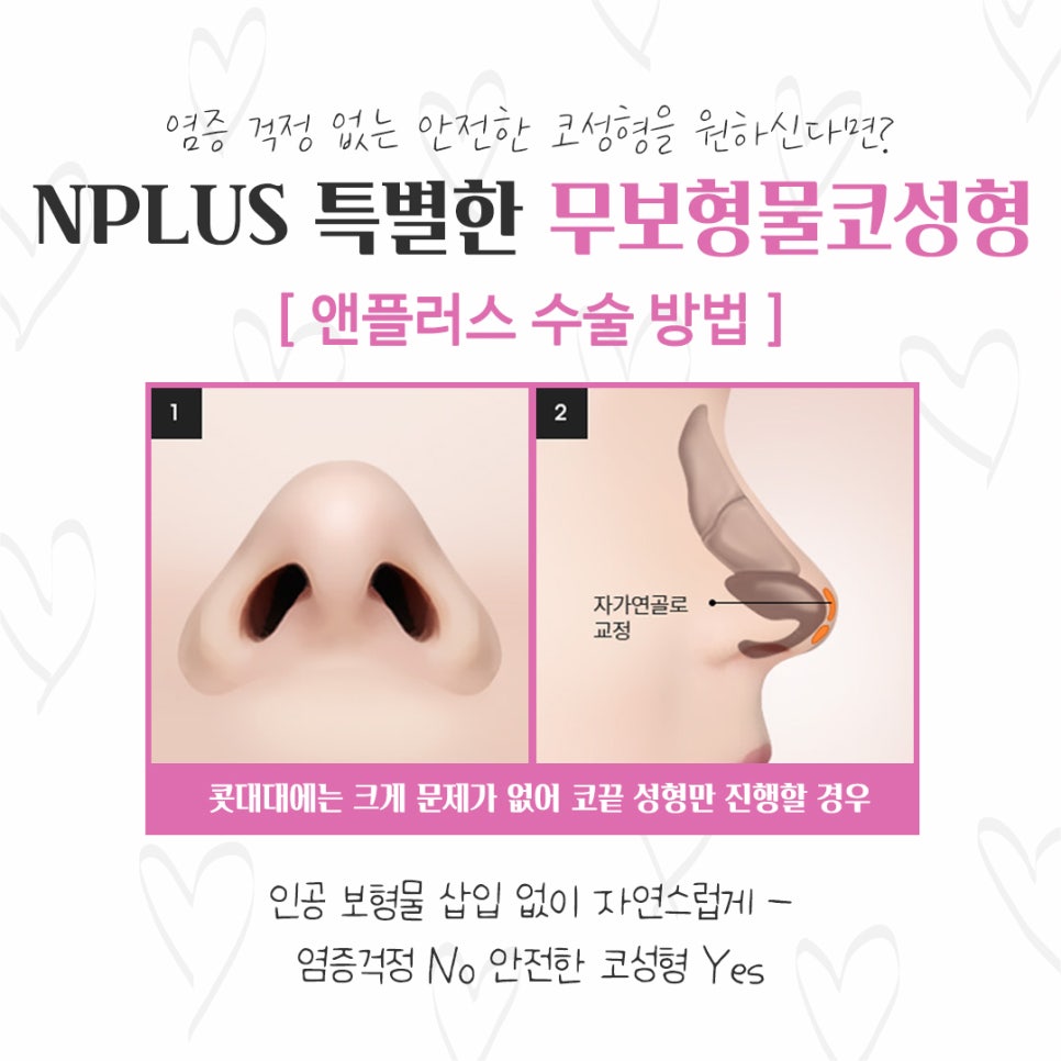 Checking Whether Non-Implant Nose Surgery Is Possible image 8