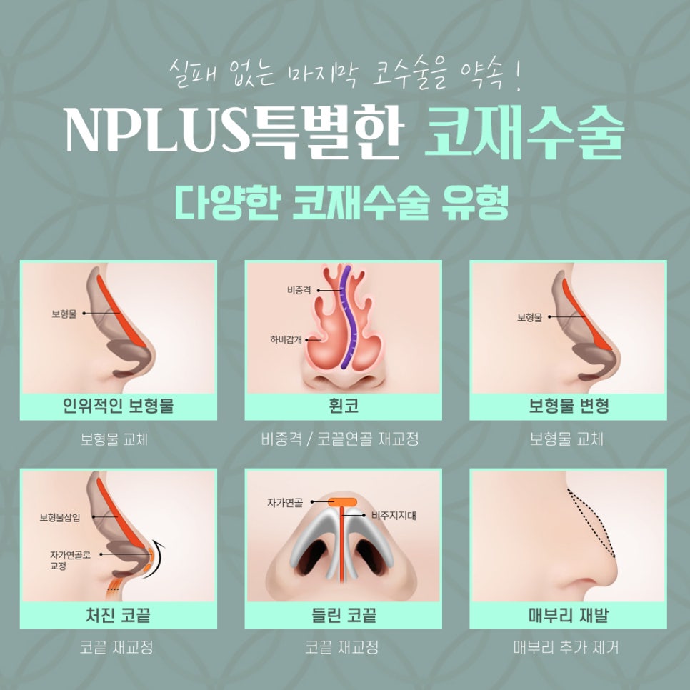 압구정성형외과에서 알아보는 코재수술후기 관련 이미지 5