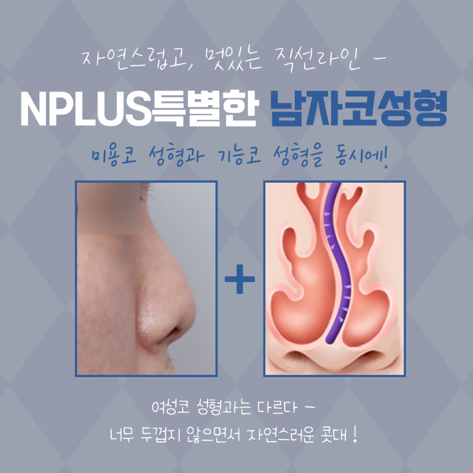 Where to Get Male Rhinoplasty Done Well: Natural and Refined image 5