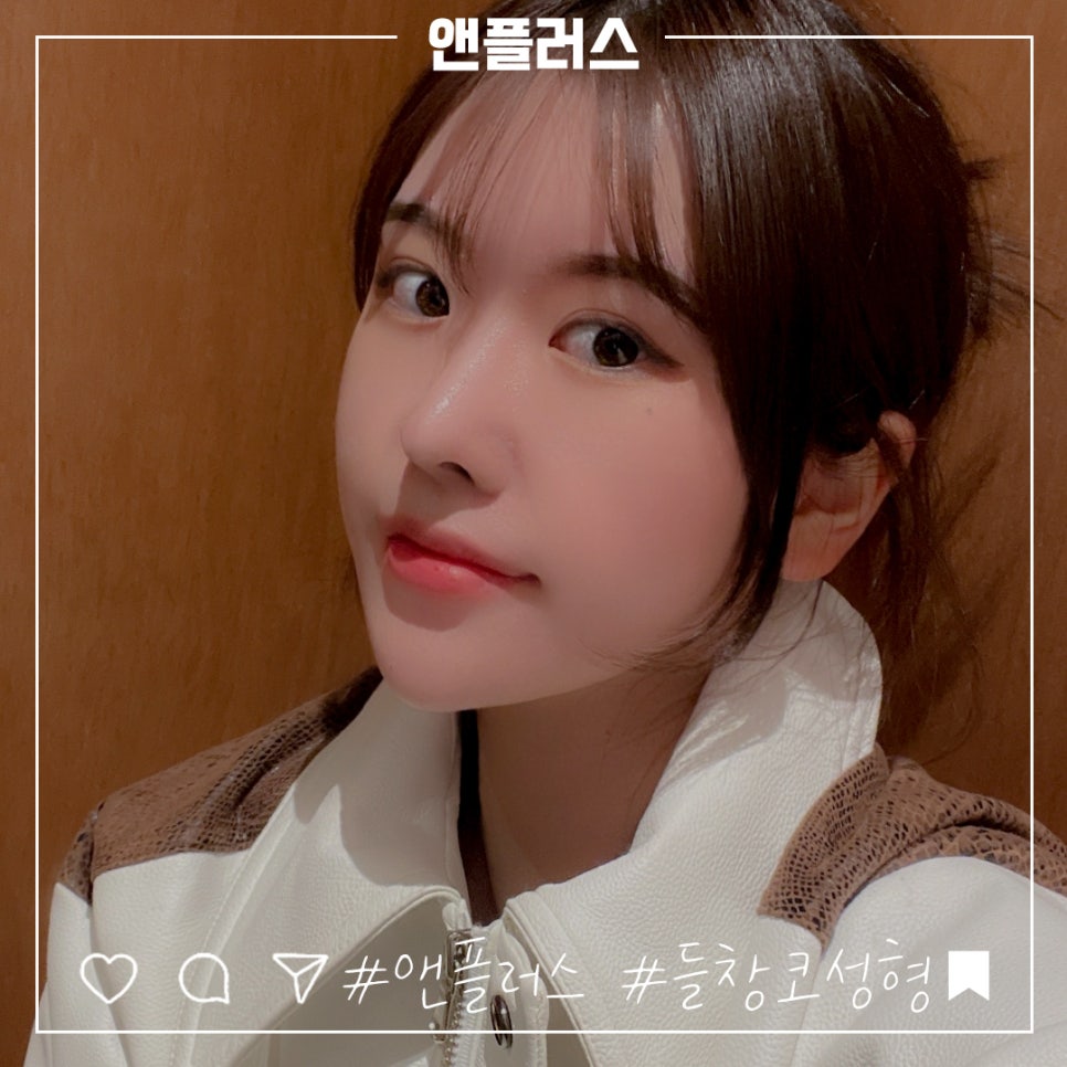 짧은코성형을 통해 세련된 이미지로 관련 이미지 1