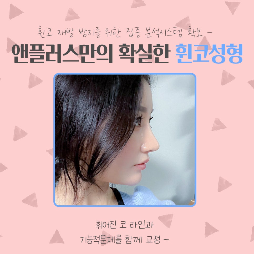 휜코수술후기 꼼꼼하게 알아보고 관련 이미지 4