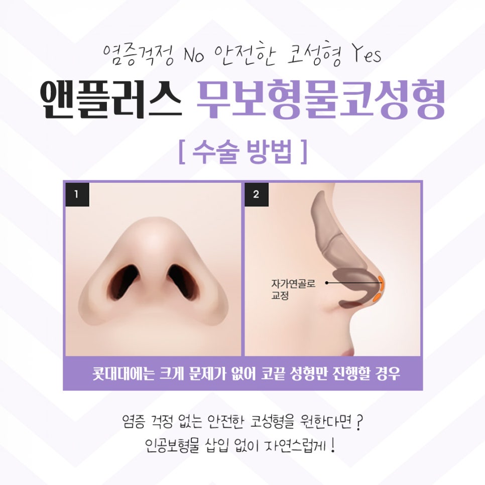 Learn More in Detail About Reviews of Nose Surgery Without Implants image 11