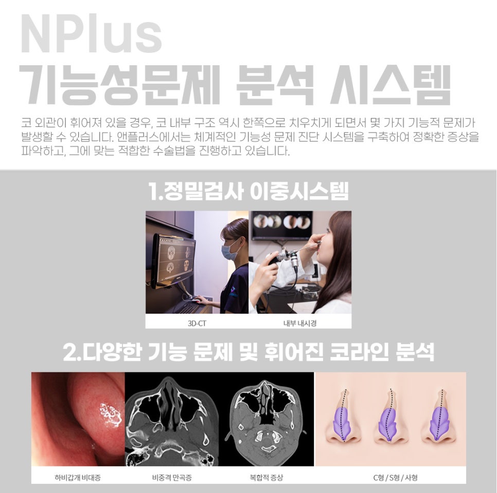 Crooked Nose Surgery Review_Confirmed Down to the Internal Structures image 5