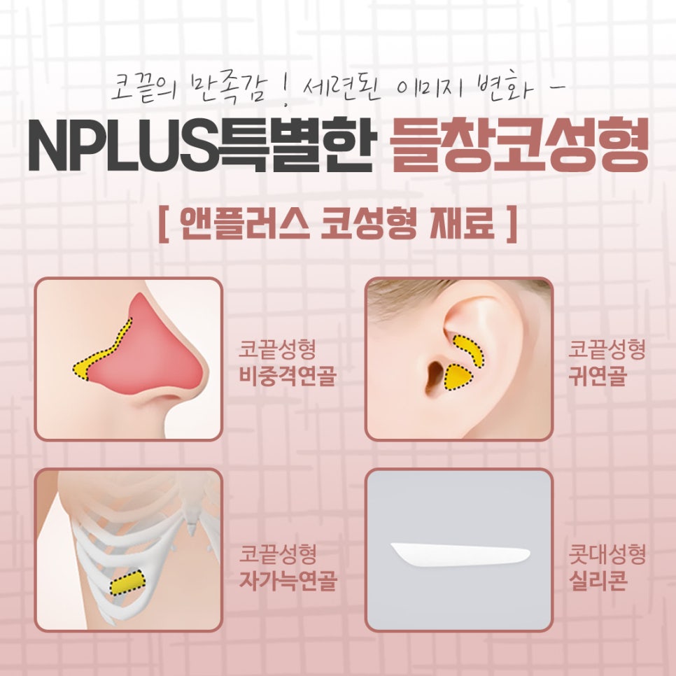 A Refined Look After Reviewing Upturned Nose Surgery Results image 9