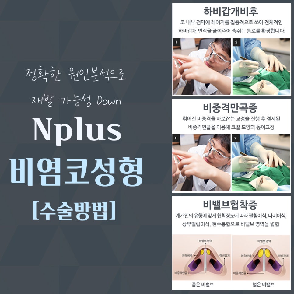 비염수술 방법과 후기까지 관련 이미지 8