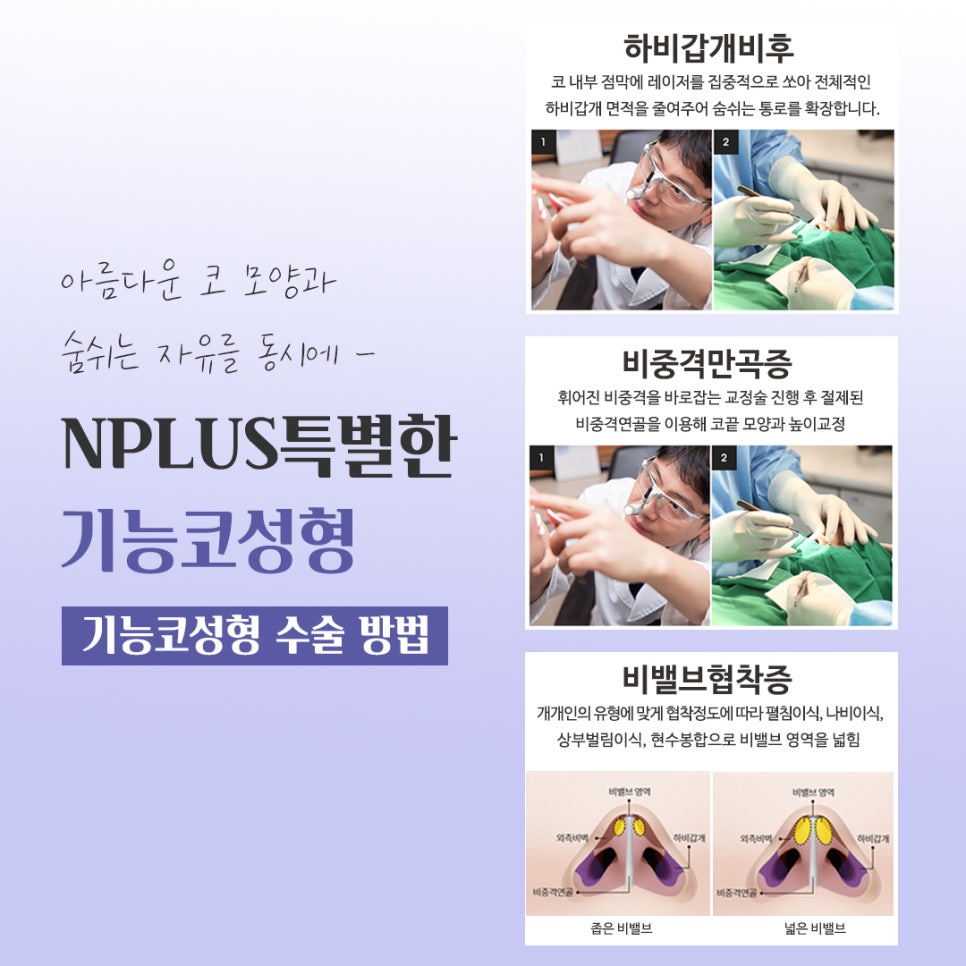 Check the Difference in Functional Nose Surgery Reviews image 9