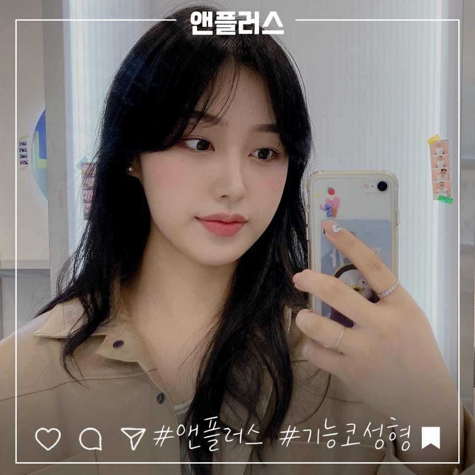 코성형후기 자연스럽고 아름답게 관련 이미지 3