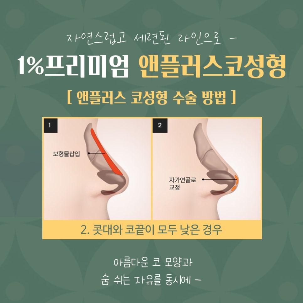 자가늑코성형 후기까지 확인하고 관련 이미지 9