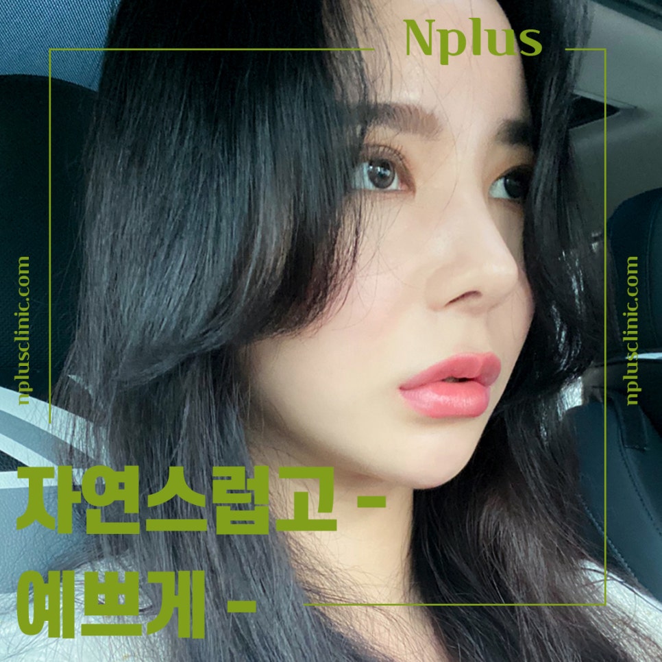 Whistling Nose Surgery Review: A Natural and Beautiful Line image 11