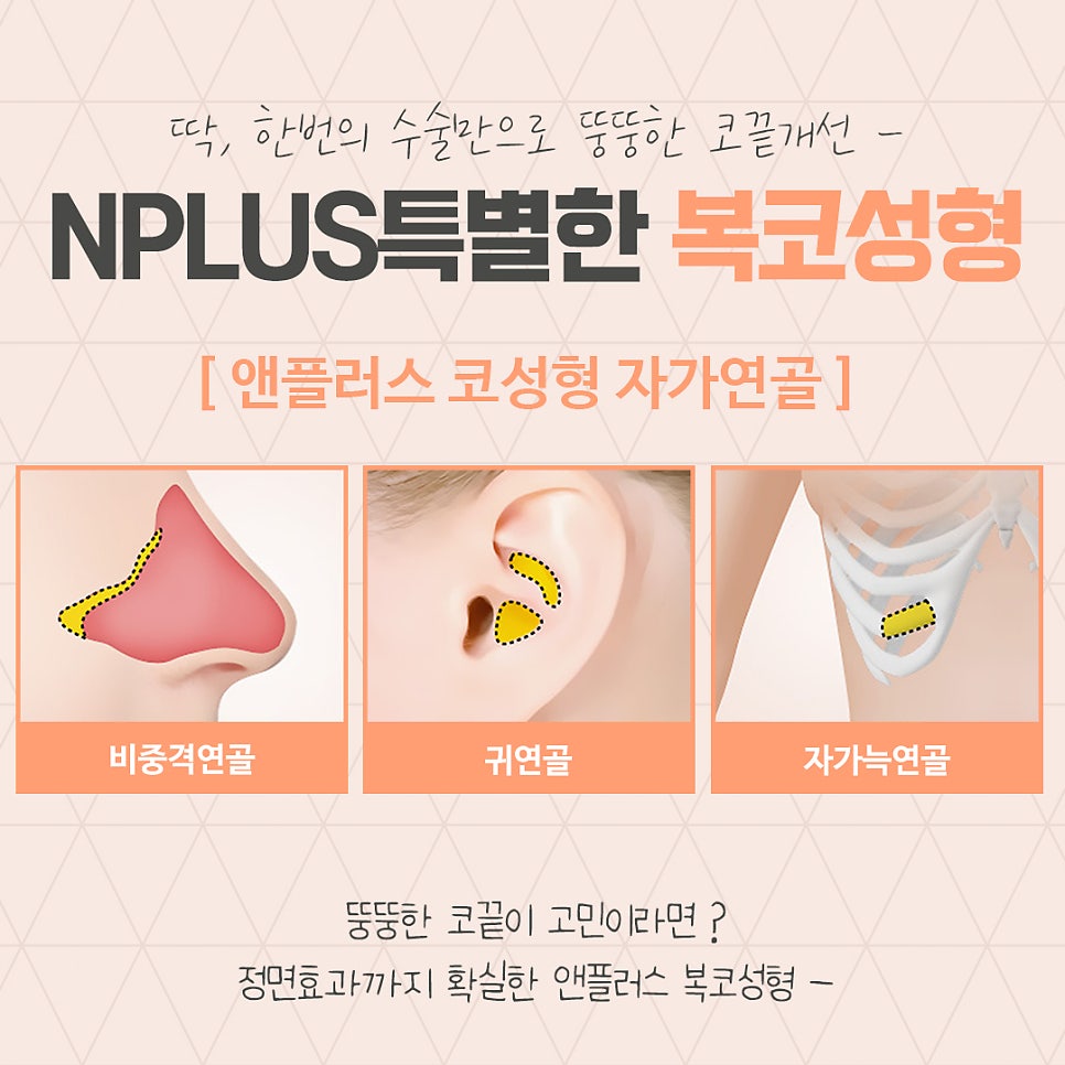 A Clear Bulbous Nose Surgery Review with Nasal Fat Removal image 10