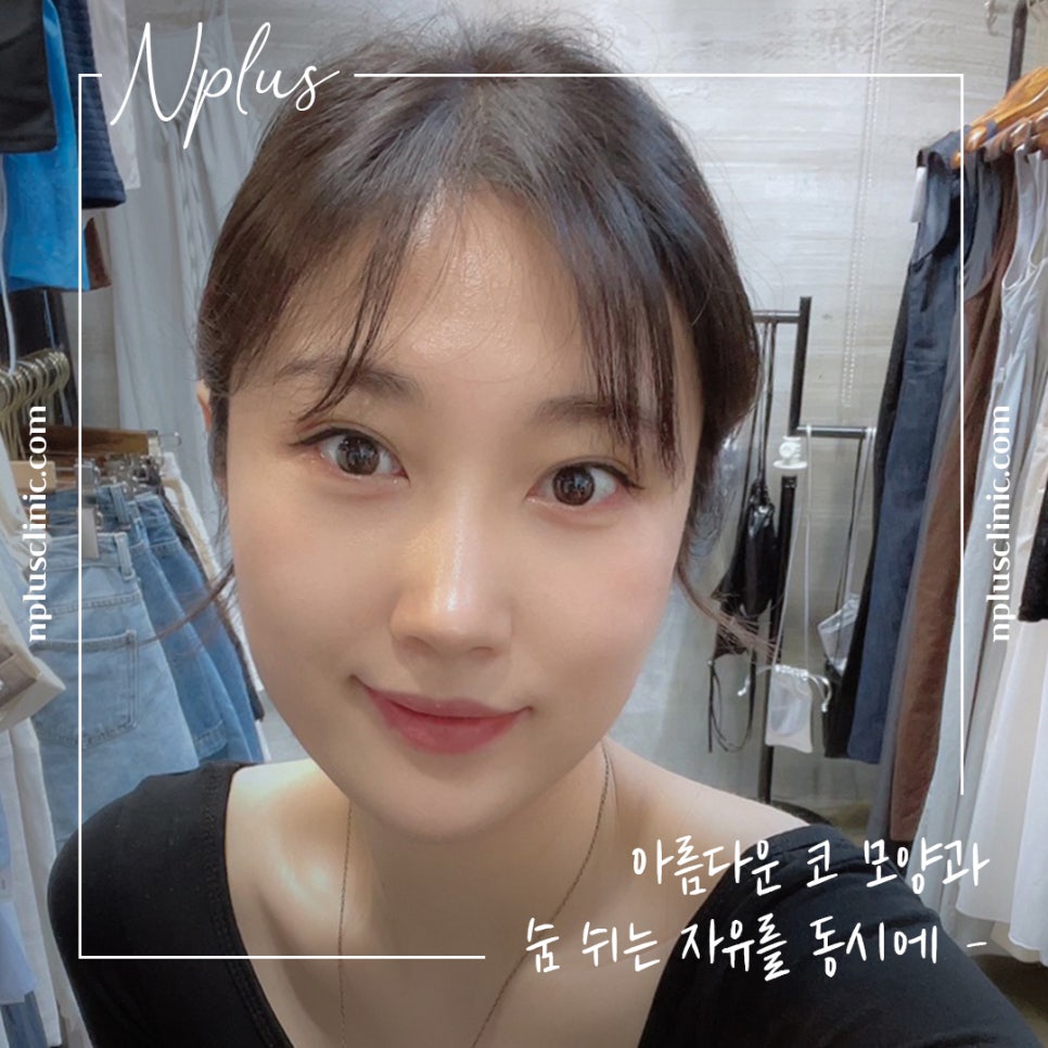자가늑연골코성형을 통한 이미지 개선 관련 이미지 7