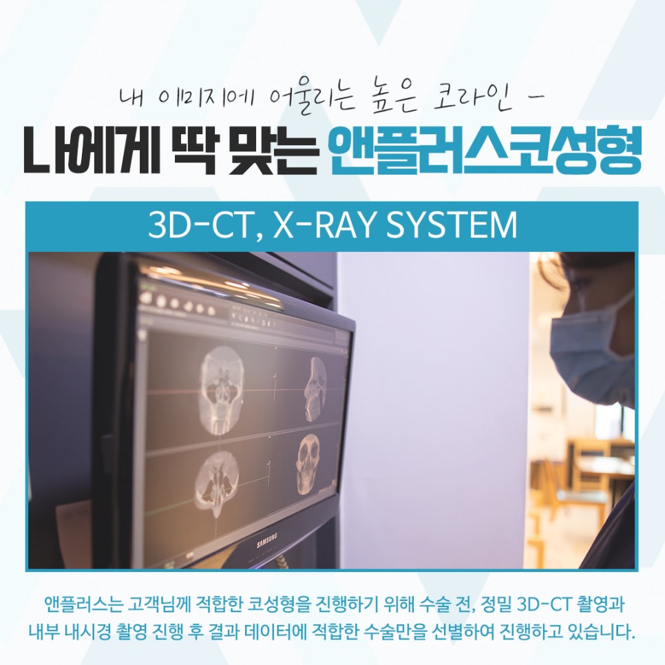 코성형후기 다양한 이미지를 고려하여 관련 이미지 7